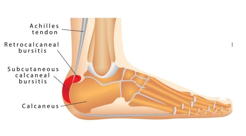 Ankle diagram